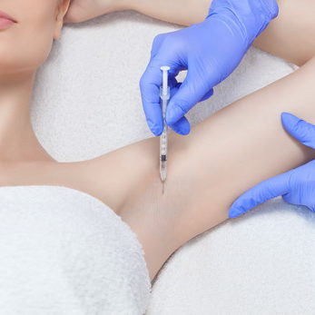 The doctor makes intramuscular injections of botulinum toxin in the underarm area against hyperhidrosis.